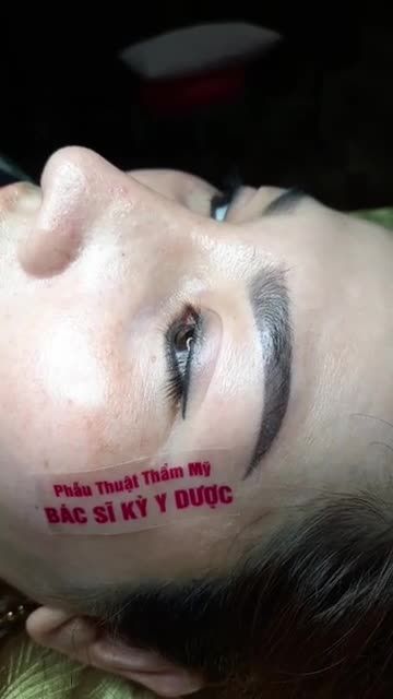 KHÁCH HÀNG TÁI KHÁM SAU 10 NGÀY PHẪU THUẬT
