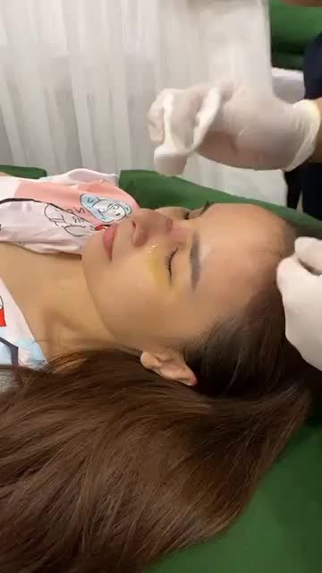 Khoảnh khắc hồi hộp không kém lúc nâng mũi đó là ngày tháo nẹp mũi.