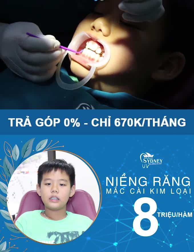 NHỮNG TRƯỜNG HỢP CẦN PHẢI NIỀNG RĂNG CHO TRẺ