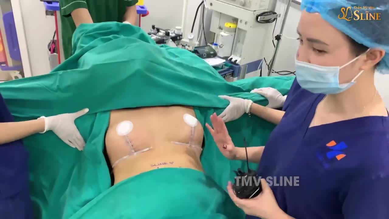 KẾT QUẢ SAU CA THU NHỎ NGỰC PHÌ ĐẠI.