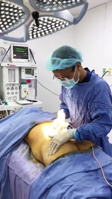 Quá trình cấy mỡ MÔNG  Cải thiện tối đa vòng 3 Tại bệnh viện thẩm Mỹ Đông Á Sài Gòn