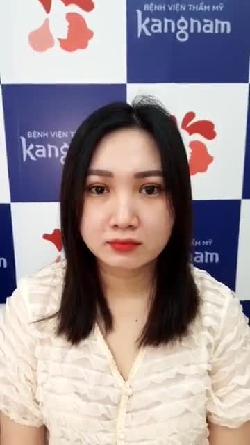 Kangnam tặng 999 suất cắt mí GIÁ CỰC SỐC