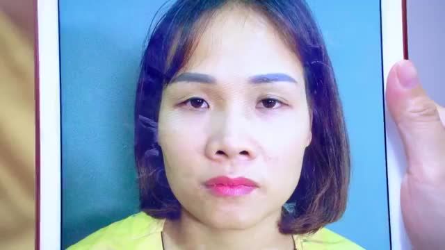 MẮT NHIỀU KHUYẾT ĐIỂM NHƯ THẾ NÀO DR.HẢI LÊ ĐỀU CÓ THỂ KHẮC PHỤC CHO BẠN