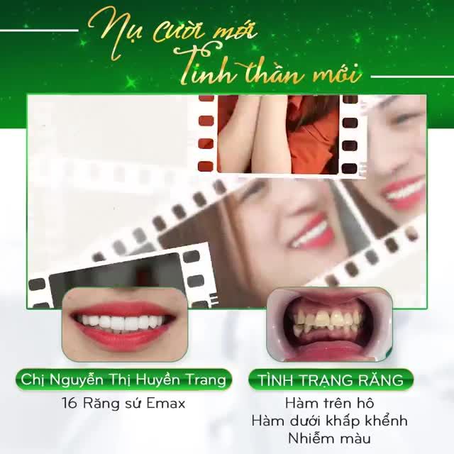MỘT NỤ CƯỜI MỚI MỘT TINH THẦN MỚI