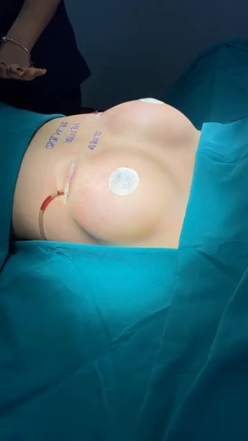 ĐẾN SLINE LÉP KẸP ĐẾN ĐÂU CŨNG HOÁ ĐẸP