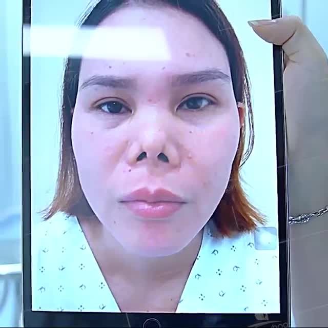 MŨI CO RÚT NẶNG, MƯNG MỦ KHÔNG CƠ SỞ NÀO DÁM NHẬN ĐẾN GANGWHOO 60 PHÚT KẾT QUẢ BẤT NGỜ