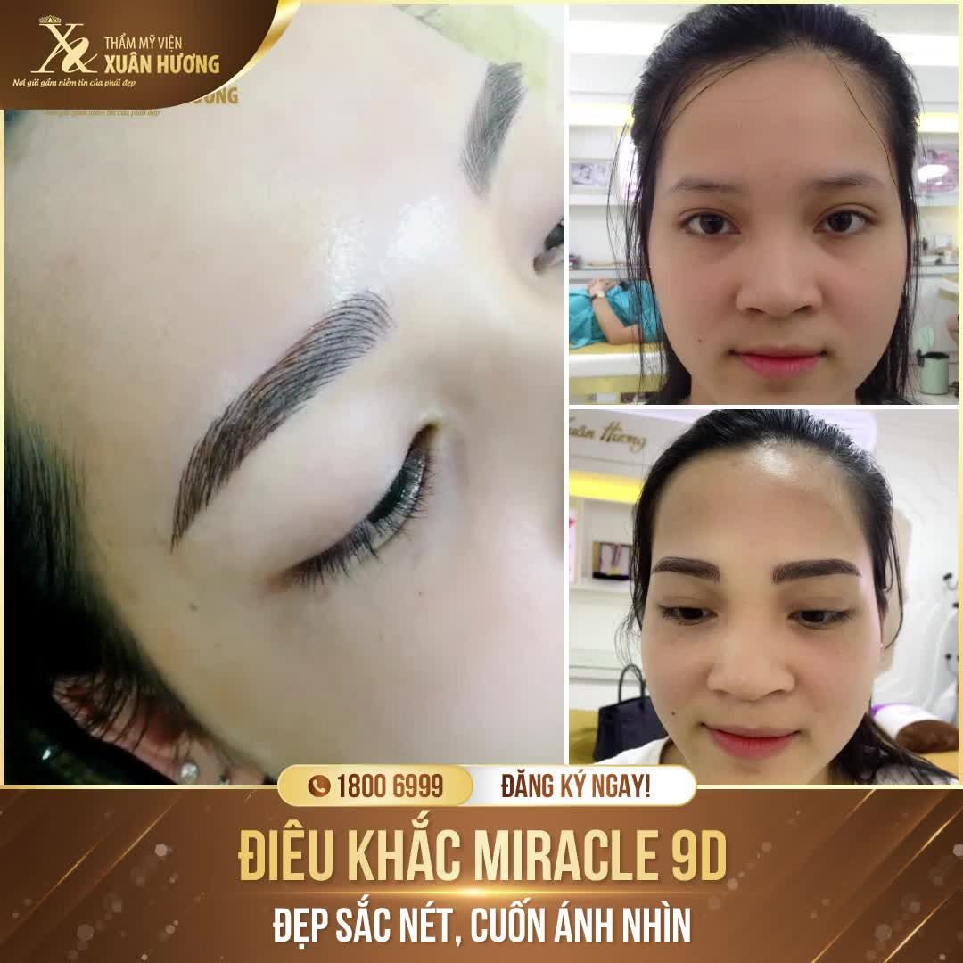 THAY ĐỔI NHAN SẮC NGOẠN MỤC SAU KHI ĐIÊU KHẮC MÀY MIRACLE