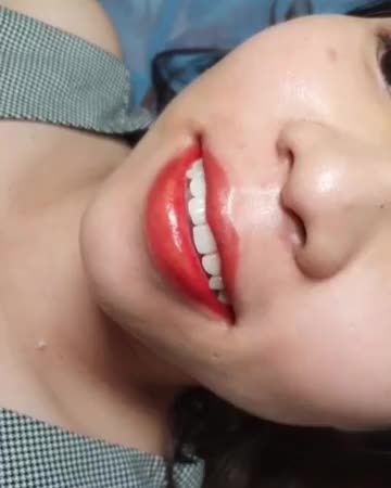 Phun môi Babylip môi đẹp rạng rỡ, không đau, ít sưng, kết quả bên đẹp, môi bóng mịn màng