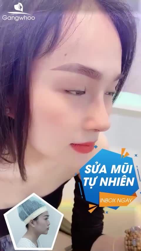 CHẤM DỨT TÌNH TRẠNG TỰ TI VỚI CHIẾC MŨI THẤP TẸT - LÊN FORM ĐẸP TỰ NHIÊN CHỈ VỚI 1 TUẦN