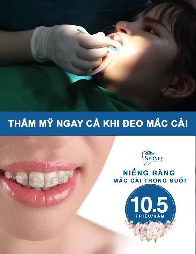 NGUYÊN TẮC VÀNG ĐỂ RĂNG KHỎE KHI NIỀNG RĂNG