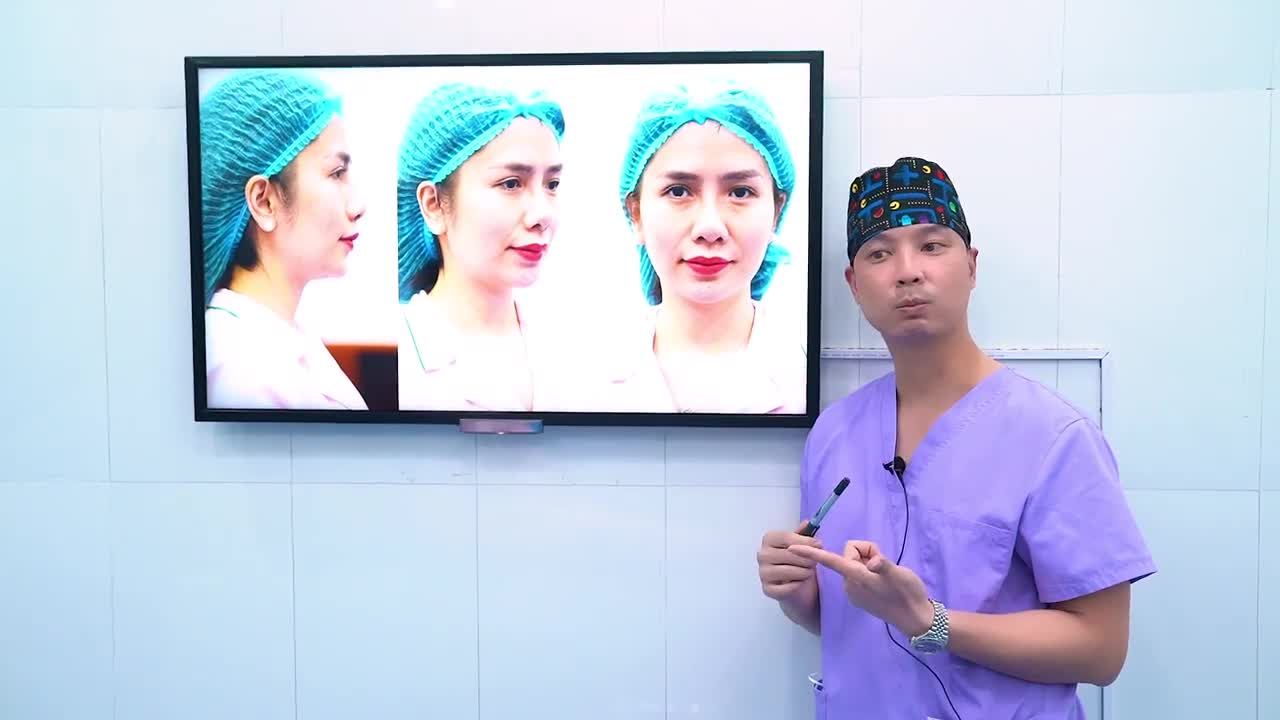 XINH ĐẸP NHƯ MC TRUYỀN HÌNH NHỜ SIÊU COMBO 3 DỊCH VỤ : NÂNG MŨI + CẤY M Ỡ + MỞ GÓC MẮT tại Dr Minh Phạm 108