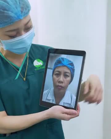 KẾT QUẢ NÂNG CUNG MÀY HẠ TUỔI TÁC CHỈ SAU 1 LẦN THỰC HIỆN