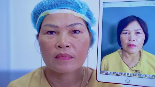 Khách hàng trẻ trung hơn sau 45 phút thực hiện tiểu phẫu Nâng cung mày