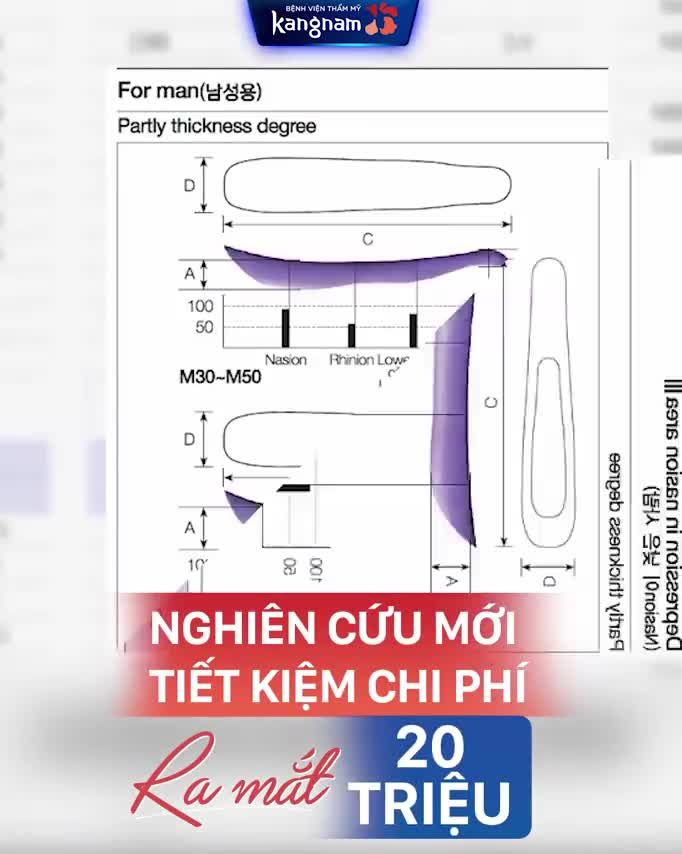 Chỉ 13 Triệu - Có ngay MŨI BAY với NÂNG MŨI K-NOSE
