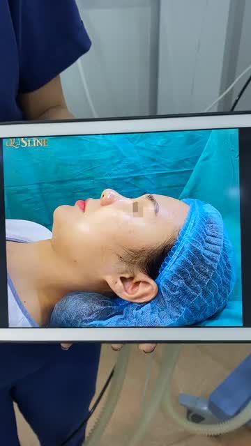 BÍ QUYẾT SỞ HỮU DÁNG MŨI VẠN NGƯỜI MÊ