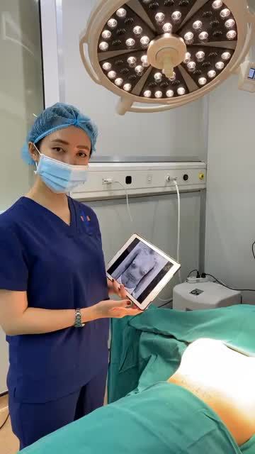 VÒNG 1 "DẬY THÌ" THÀNH CÔNG SAU KHI ĐẾN VỚI EKIP SLINE