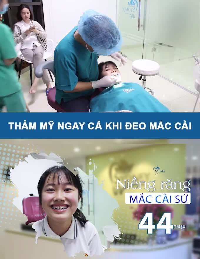 NIỀNG RĂNG MẮC CÀI SỨ TỰ BUỘC NHANH GỌN LẠI THẨM MĨ