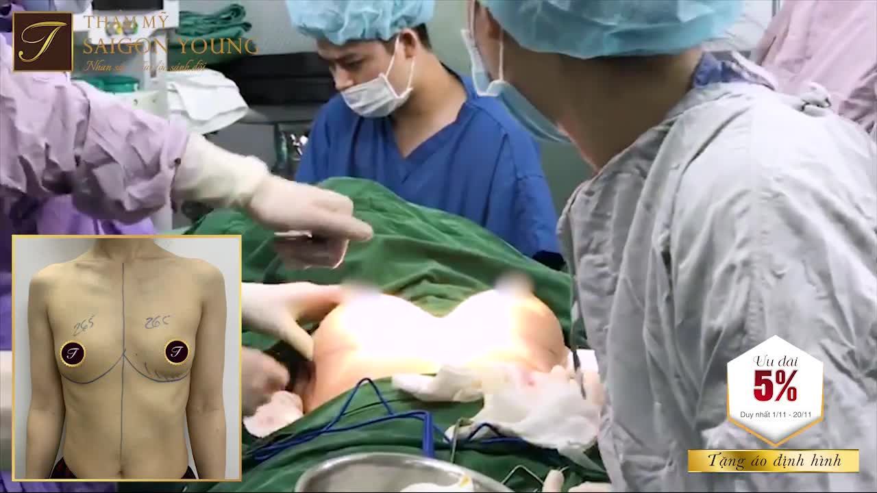 ƯU ĐÃI VÀNG CHO NÀNG NÂNG NGỰC