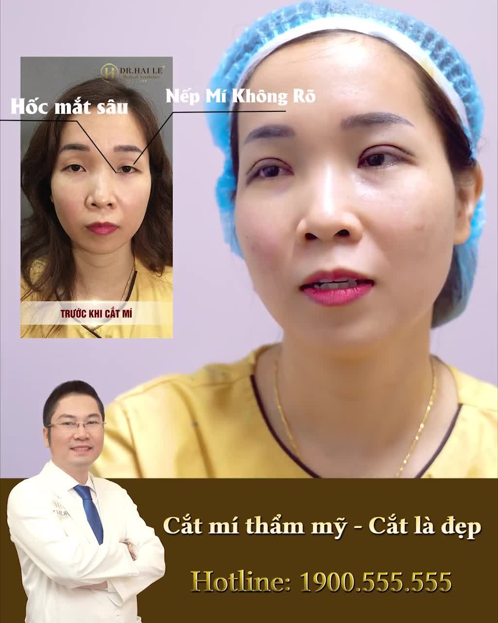 "THEO DÕI LIVESTREAM CỦA DR.HẢI LÊ THẤY RẤT NHIỀU KẾT QUẢ ĐẸP, NÊN MÌNH TIN TƯỞNG VÀ QUYẾT ĐỊNH THỰC HIỆN DỊCH VỤ Ở ĐÂY "