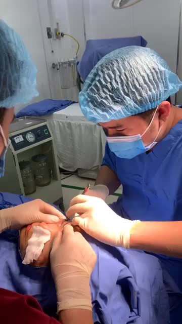 Combo Perfect Eyes - Cắt mí dưới + Xóa rãnh lệ