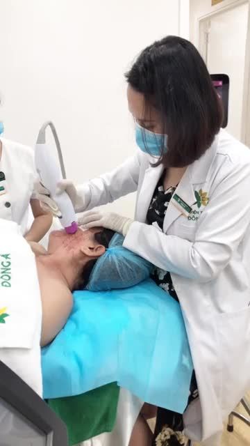 Quá trình Trẻ Hóa da Thermage tại Đông