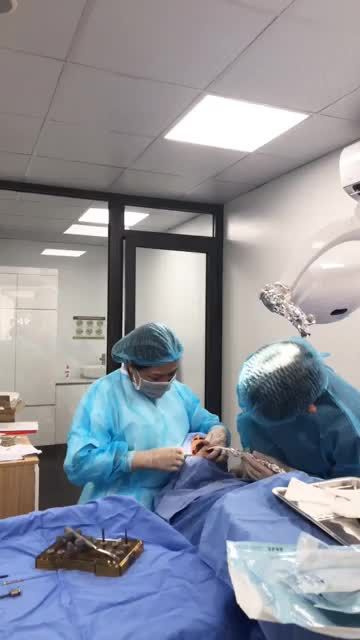 Ca cấy ghép 02 trụ Dentium Hàn Quốc do Bác sĩ/ Tiến sĩ Đàm Ngọc Trâm và Bác sĩ Tạ Quang Lưu thực hiện tại chi nhánh Quảng Ninh