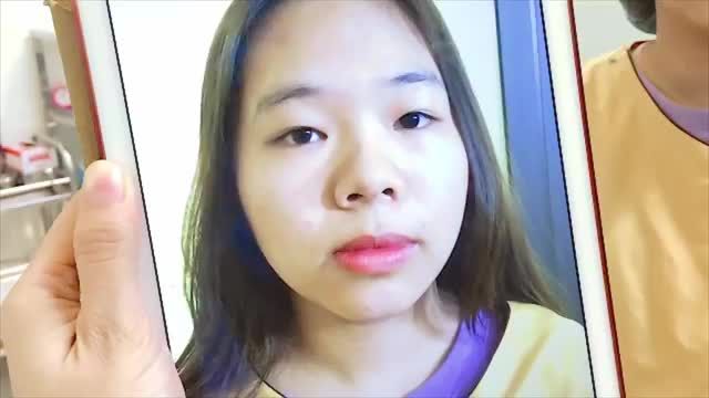 Em gái tuổi đôi mươi sở hữu đôi mắt rạng ngời tươi trẻ chỉ sau 45 phút thực hiện tiểu phẫu Cắt mí tại Dr.Hải Lê