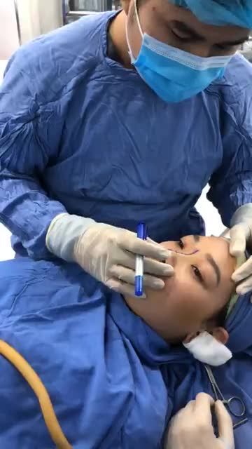 Combo lột xác xinh đẹp "Nâng mũi cấu trúc 4D Nanoform + Độn cằm Vline"