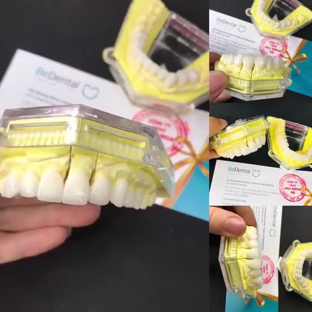 CHUẨN BỊ LẮP RĂNG CHO KHÁCH HÀNG CỦA BE