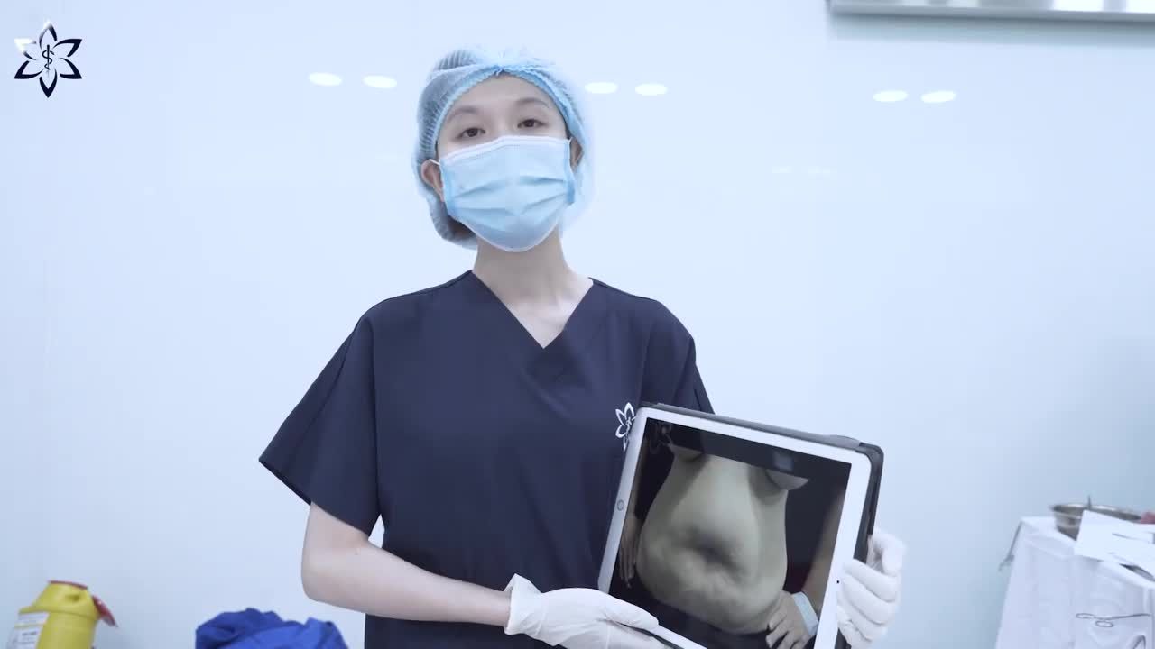 GIẢI PHÁP AN TOÀN LẤY LẠI NÉT THON THẢ CHO "VÒNG 2" SAU SINH CHỈ VỚI 90 PHÚT