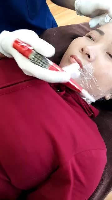 Khách hàng quay lại bảo hành phun môi nano lần 2.