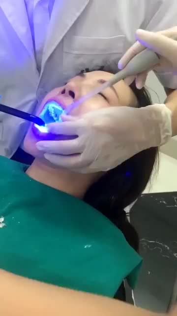 KHÁCH HÀNG TRẢI NGHIỆM DỊCH VỤ DÁN SỨ VENEER TẠI NHA KHOA GIA ĐÌNH