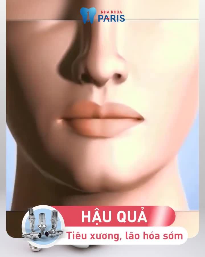Mất Răng Do Sâu Vỡ Tuổi Già Tai Nạn???