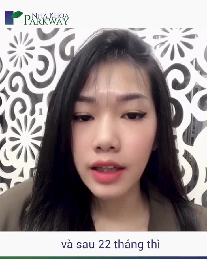 NIỀNG RĂNG ĐÃ GIÚP MÌNH LỘT XÁC NHƯ THẾ NÀO?