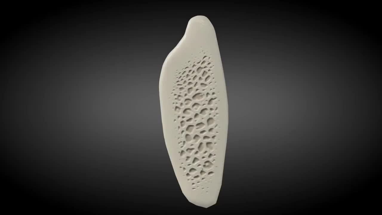 TRƯỜNG HỢP NÀO CẦN GHÉP XƯƠNG KHI TRỒNG RĂNG IMPLANT ?