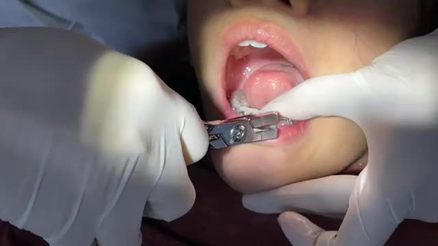BUNG LỤA CHO KHÁCH HÀNG ỨNG KHÁNH LINH RĂNG KHẤP KHỂNH