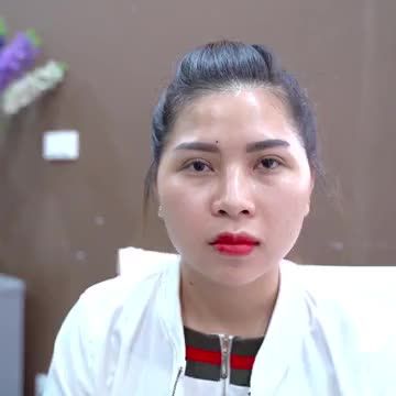 Trải lòng của khách hàng sau 3 lần Cắt mí hỏng tại spa và sửa lần 4 thành công tại Dr.Hải Lê