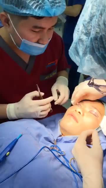 Kết quả ngay sau khi CẮT MÍ của chị khách hàng