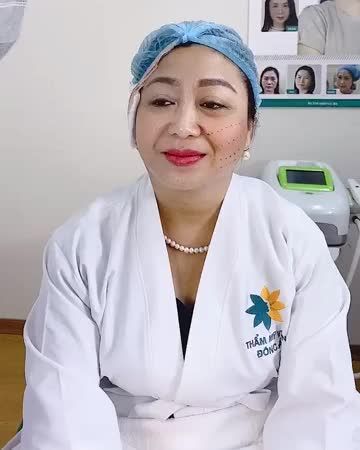 "Nửa mặt được nâng cơ, hết nhăn, tràn sức sống. Nửa mặt vẫn xập xệ, trùng nhão, nếp nhăn sâu!" Căng chỉ Bio Lift