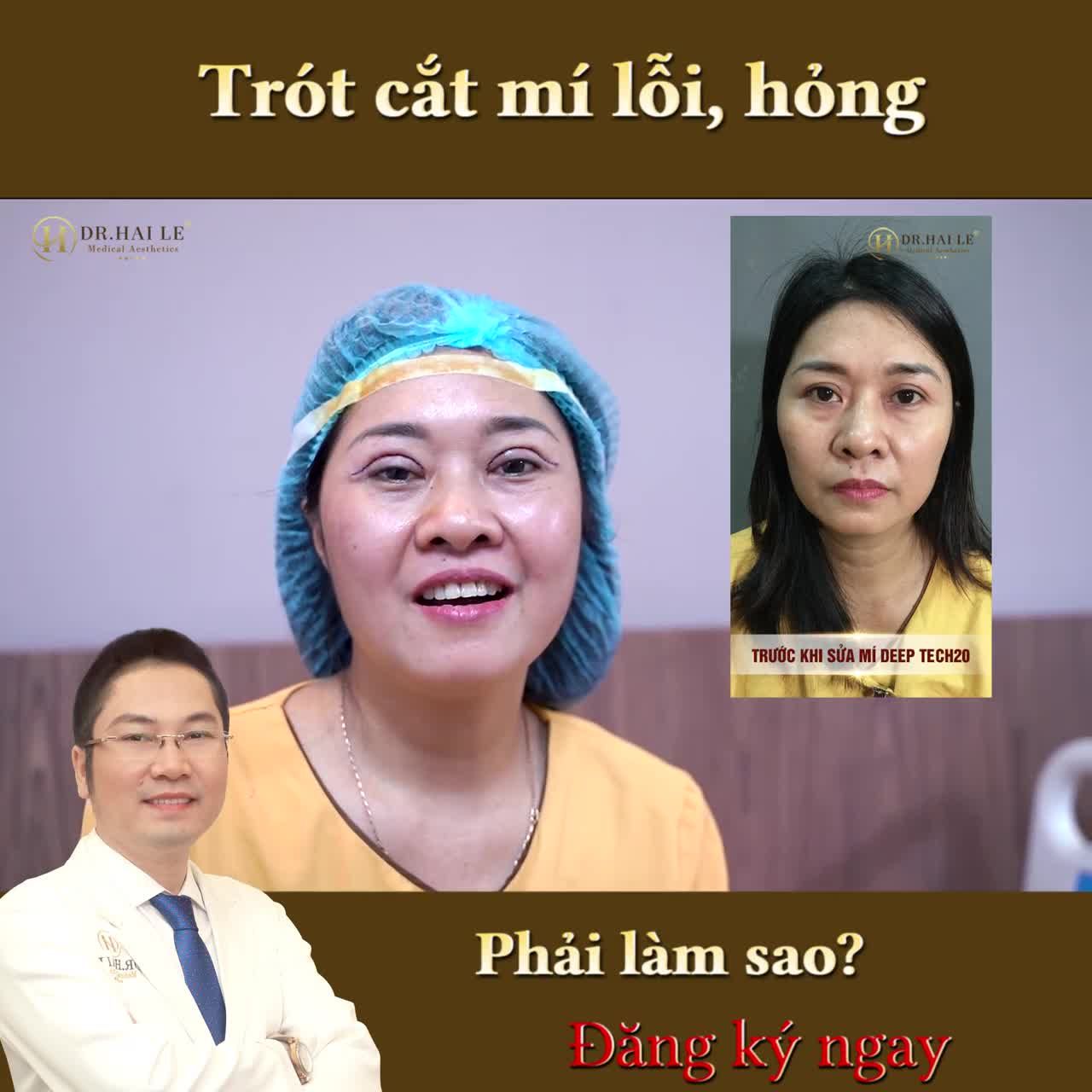 Trót cắt mí lỗi, hỏng có sửa lại được không