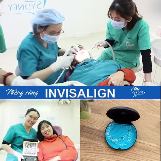 CẦN LƯU Ý ĐIỀU GÌ KHI NIỀNG RĂNG INVISALIGN