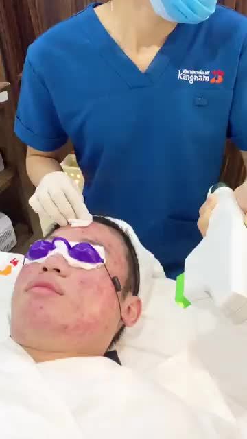 Quy trình điều trị mụn tại BVTM kangnam với công nghệ vượt trội DE ACNE