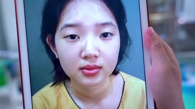 Mắt 1 mí áp dụng phương pháp Cắt mí nào để sở hữu 2 mí tươi trẻ rạng ngời? Mời quý khách hàng cùng theo dõi
