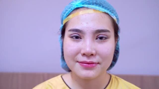 Sửa mí lần 2 có đau không? Cùng nghe vị khách hàng chia sẻ kinh nghiệm pt mí lần 2!