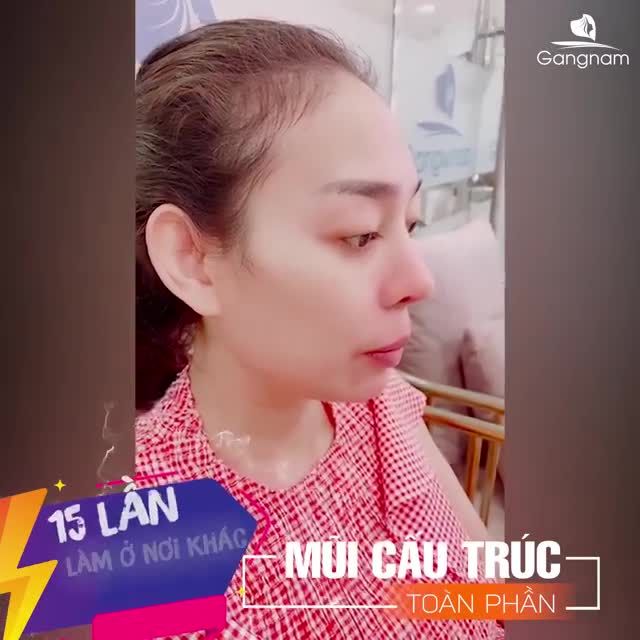 BÓNG ĐỎ, TỤT SÓNG, VIÊM SƯNG MŨI NHƯ VẬY PHẢI LÀM SAO