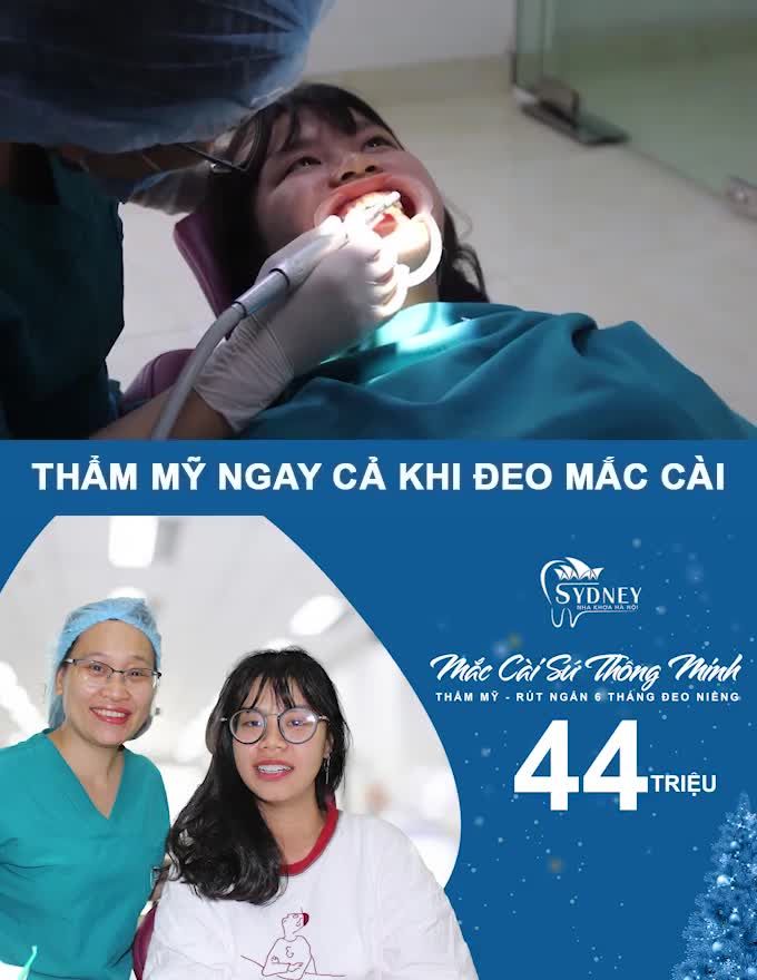 RĂNG SÁNG LẤP LÁNH TỰ TIN ĐÓN GIÁNG SINH CÙNG MẮC CÀI SỨ TỰ BUỘC