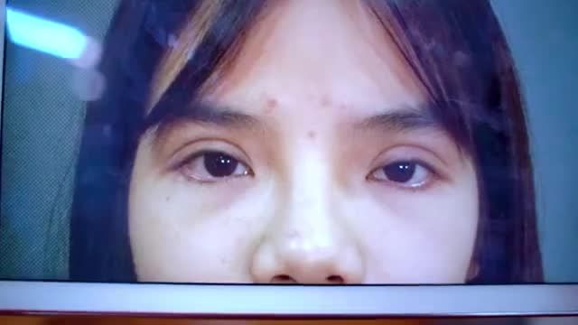Đôi mắt là cửa sổ tâm hồn, đừng để đôi mắt Lỗi hỏng do chót dại thực hiện tại các cơ sở không uy tín khiến bạn mặc cảm tự ti