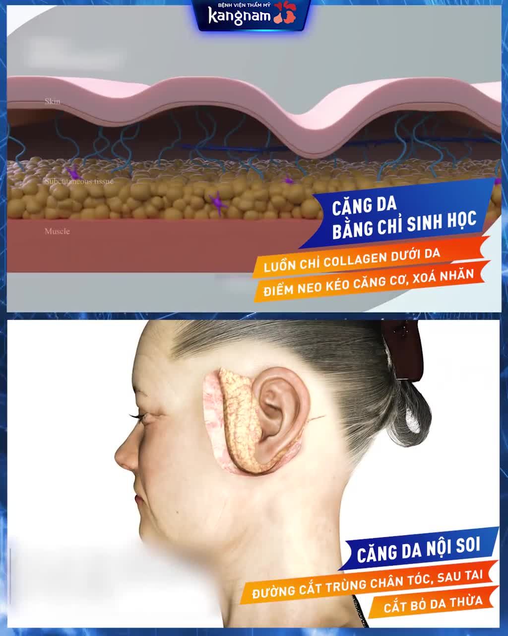 Cơ mặt lão hóa Da chùng nhão xập xệ
