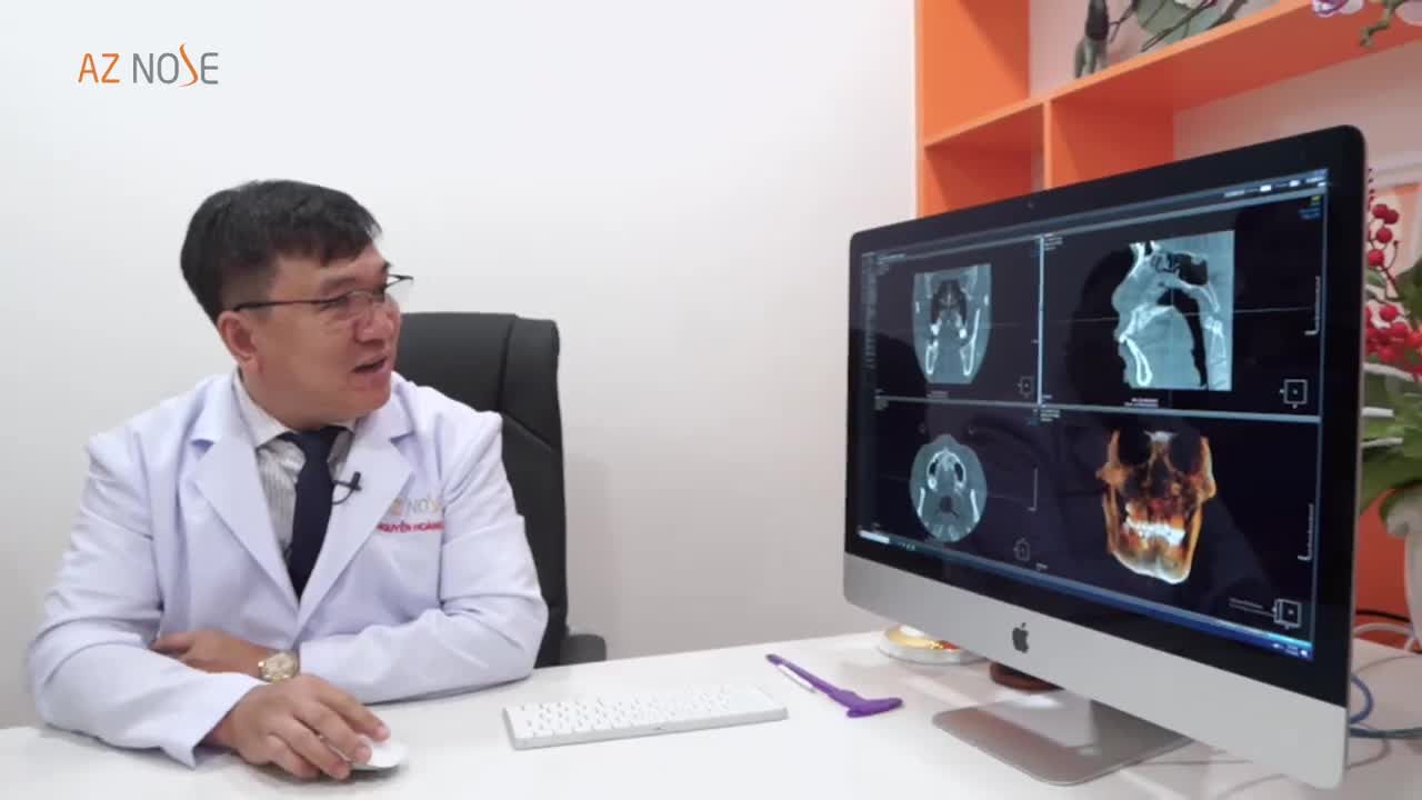 DIỄN VIÊN HÀI MINH DỰ TƯ VẤN MŨI TẠI AZ NOSE