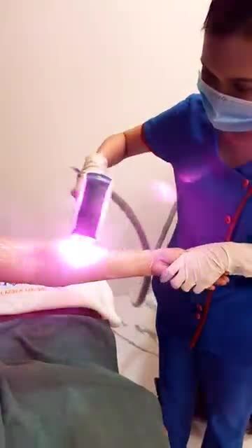 Lông Cứng Rậm rụng gần một nửa sau buổi điều